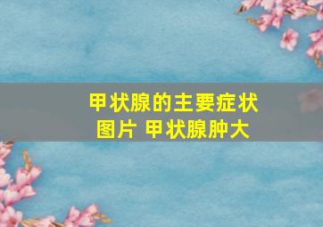 甲状腺的主要症状图片 甲状腺肿大